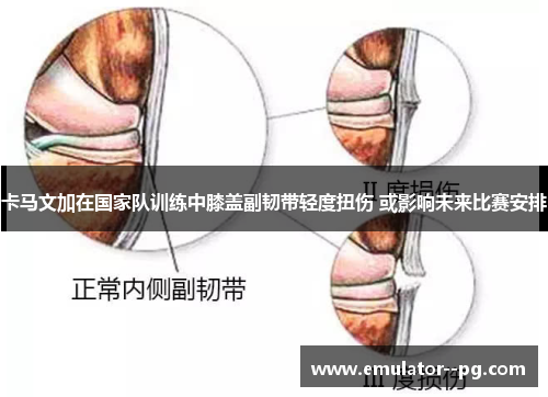 卡马文加在国家队训练中膝盖副韧带轻度扭伤 或影响未来比赛安排